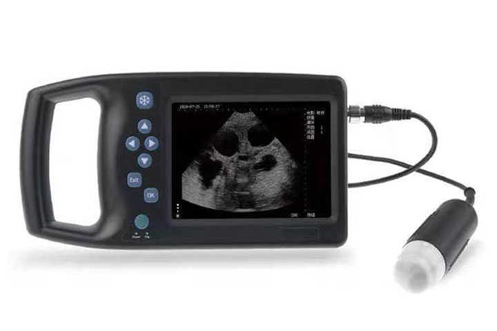 BU10x Handheld Type B Ultrasonic Scanner BU101