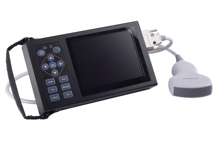 BU202 Handheld Type B Ultrasonic Scanner with 3.5MHz Abdominal convex array probe