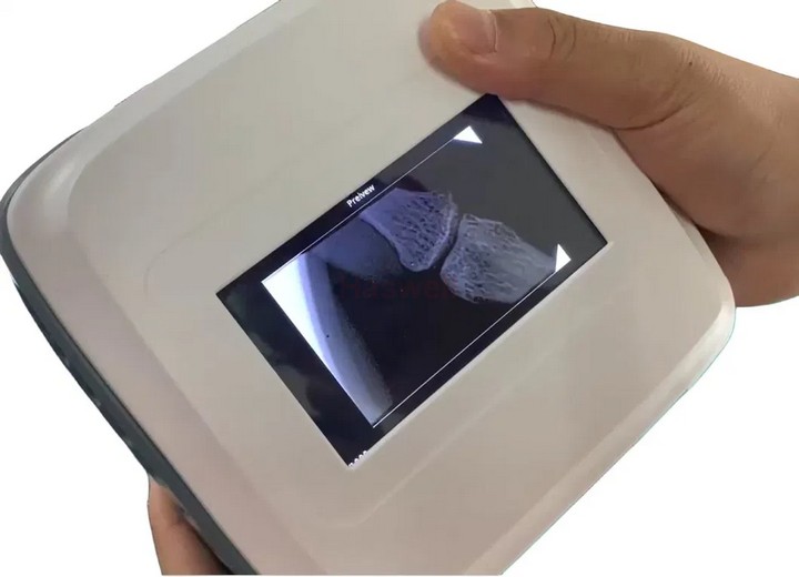 Portable Pets X-Ray Camera 05 manufacturer - China Haswell